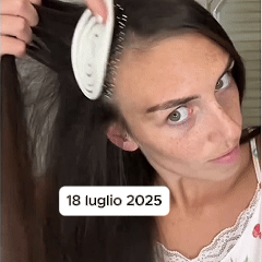 Segnali di carenza di ferro