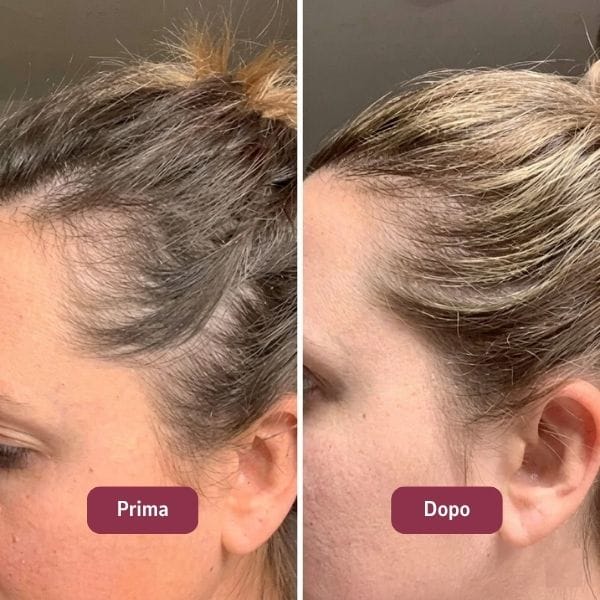 Prima e dopo — Chiara