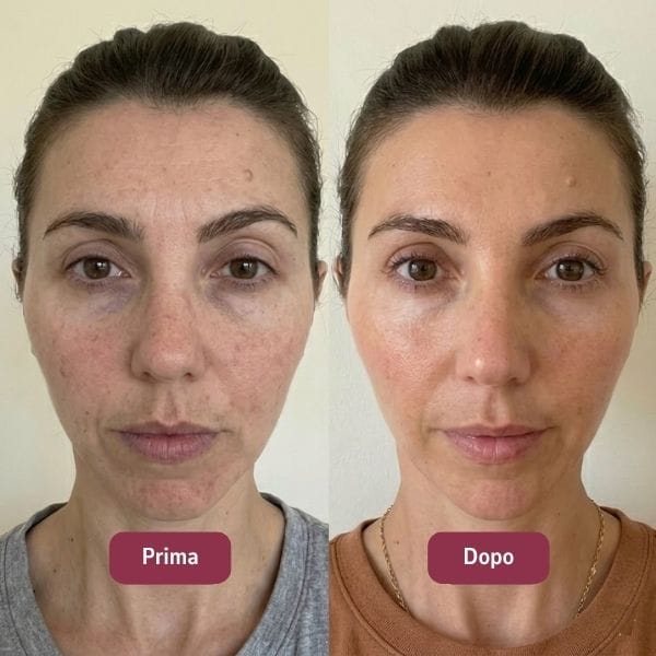 Prima e dopo — Federica